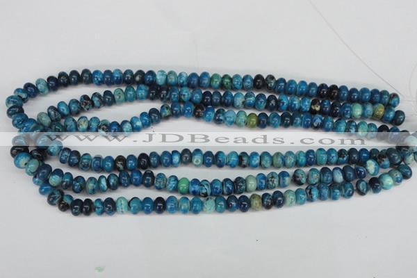 CCO170 15.5 inches 5*8mm rondelle dyed natural chrysotine beads