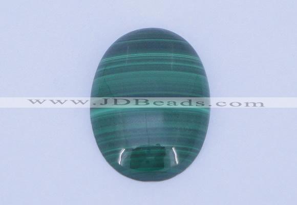 CGC01 20PCS 3*5mm oval natural malachite gemstone cabochons