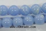 CTU1737 15.5 inches 16mm round synthetic turquoise beads